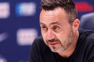 德泽尔比：失去控球权就赢不下比赛 我们必须坚持自己的打法